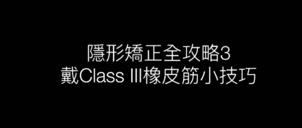 戴Class III橡皮筋小技巧 - 隱形矯正全攻略