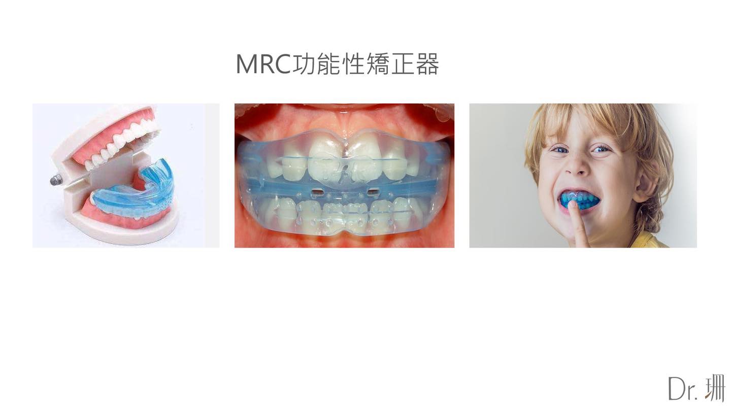 MRC功能性矯正器-兒童隱適美-台中-兒童牙齒矯正-隱適美-Dr.珊
