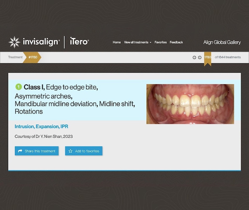 楊念珊醫師入選隱適美精選案例(Global Invisalign Gallery)