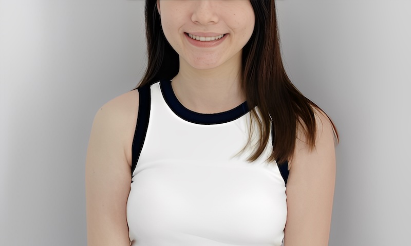 大學生小汾完成隱適美Lite輕矯正後的笑容