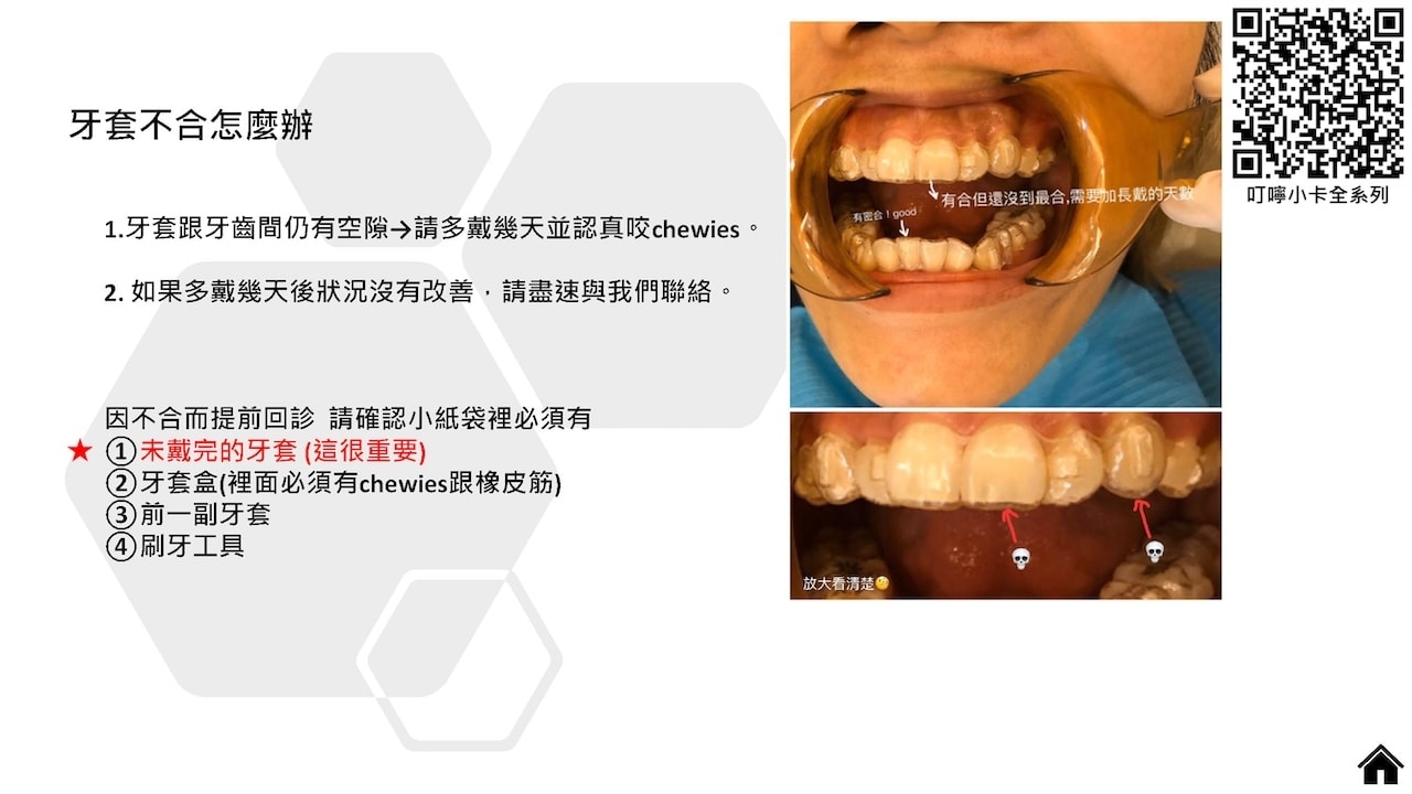 隱適美隱形牙套叮嚀小卡 - 牙套不合怎麼辦