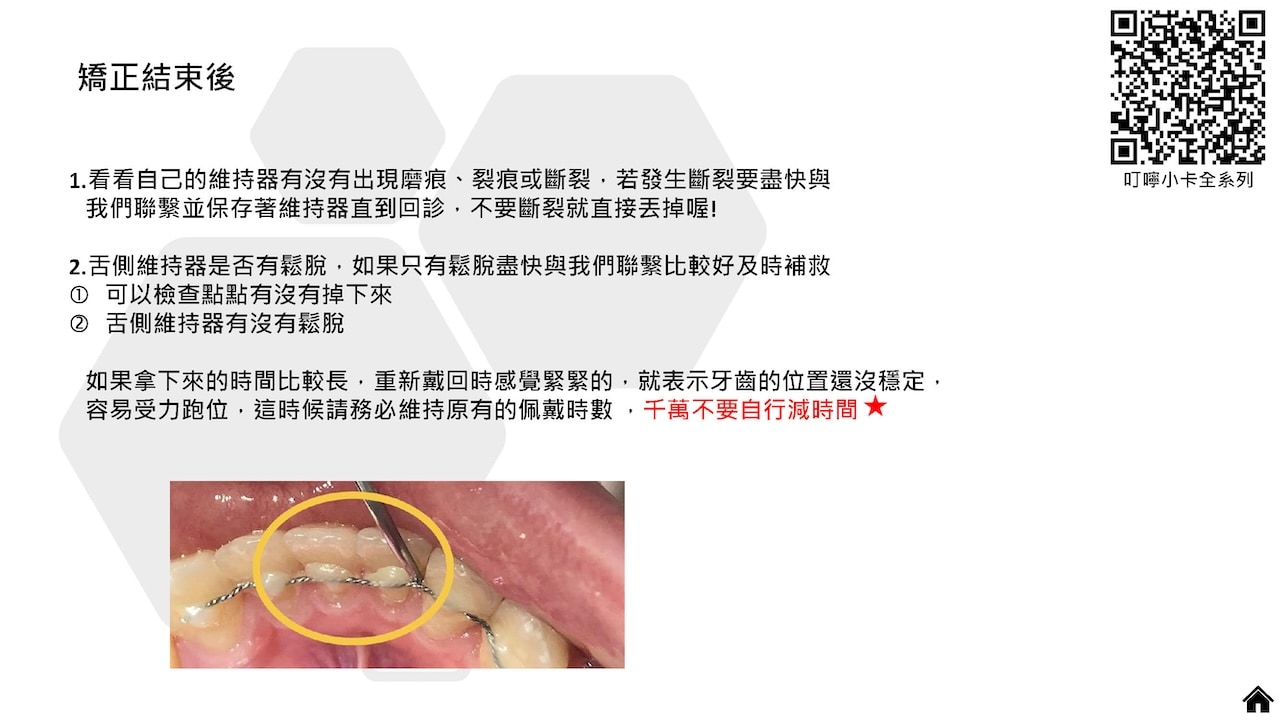 隱適美隱形牙套叮嚀小卡 - 矯正結束後