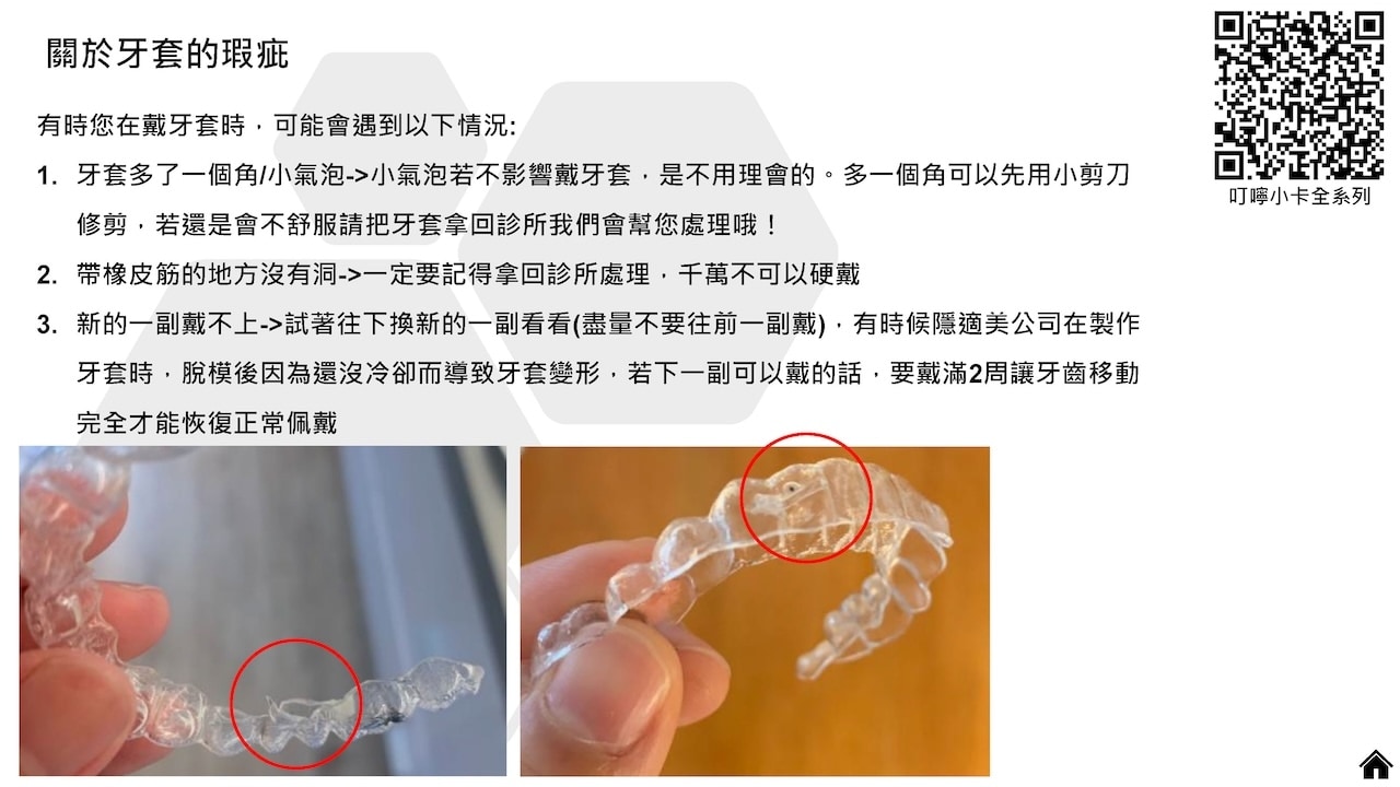 隱適美隱形牙套叮嚀小卡 - 關於牙套的瑕疵