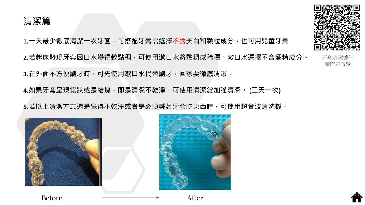 隱適美隱形牙套叮嚀小卡 - 隱適美清潔