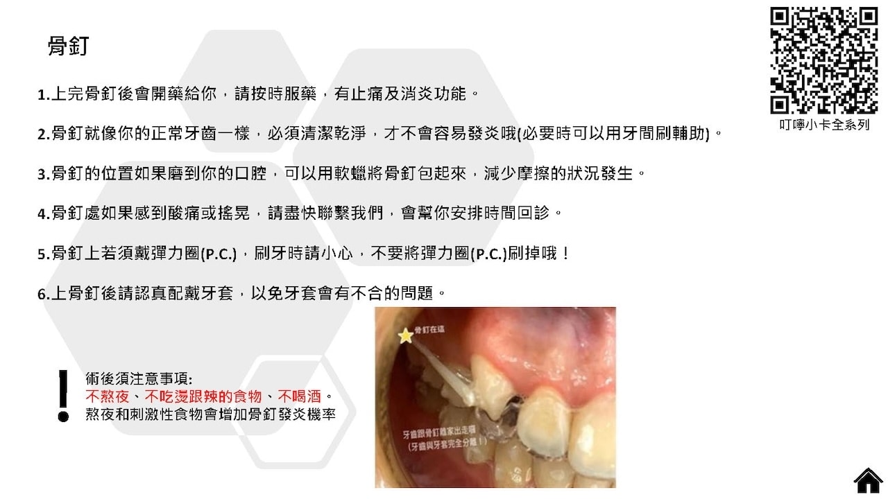 隱適美隱形牙套叮嚀小卡 - 骨釘