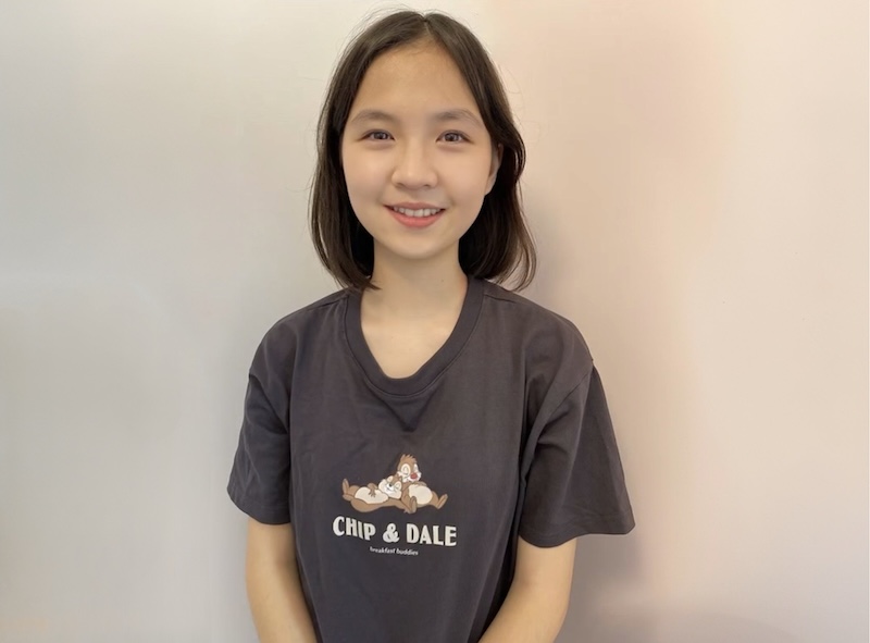 完成隱適美虎牙矯正後的患者笑容,從虎牙妹變成小臉美女